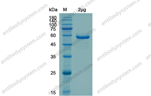 Recombinant SARS-CoV-2 NSP5/3CL-PRO/M Pro Protein, N-GST