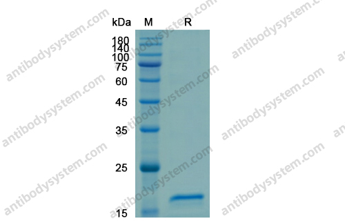 Recombinant SARS-CoV-2 NSP10/GFL Protein, N-His