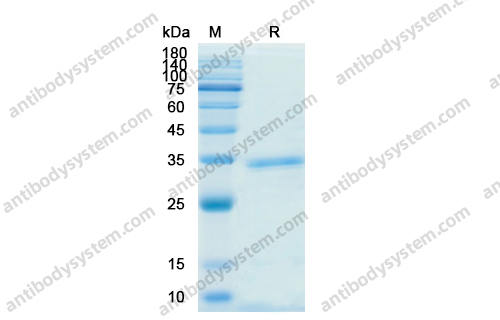 Recombinant SARS-CoV-2 NSP12/RdRp Protein, C-His