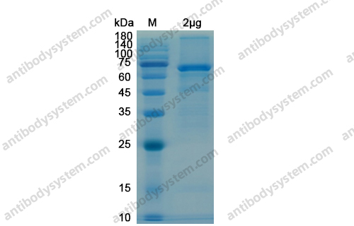 Recombinant SARS-CoV-2 NSP13 Protein, N-His