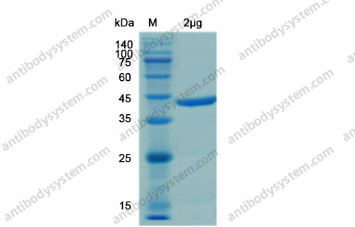 Recombinant SARS-CoV-2 NSP15 Protein, N-His