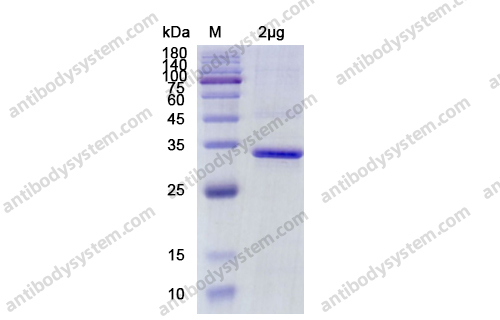 Recombinant SARS-CoV-2 NSP16 Protein, N-His