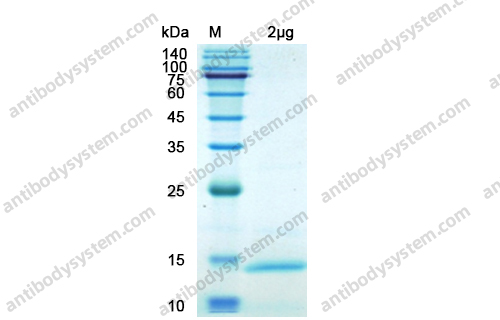 Recombinant SARS-CoV-2 ORF7a/Protein U122 Protein, N-His