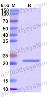 Recombinant SARS-CoV-2 ORF7a/Protein U122 Protein, N-His-SUMO