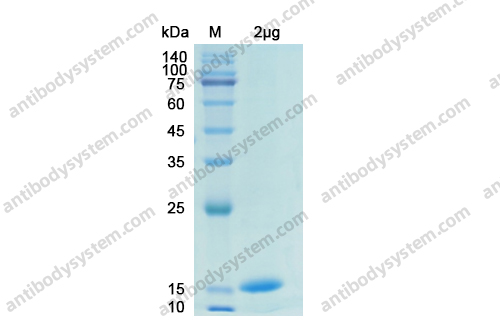 Recombinant SARS-CoV-2 ORF8/ns8 Protein, N-His