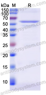 Recombinant RABV NP/Nucleoprotein Protein, C-His