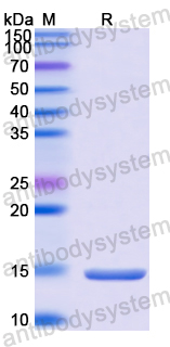 Recombinant HIV-2 env/Env polyprotein/gp36 Protein, N-His