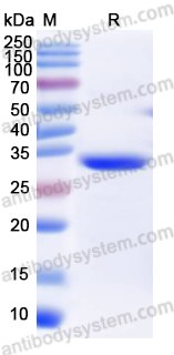 Recombinant Influenza A virus (H9N2) HA/Hemagglutinin Protein, N-His