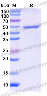 Recombinant Rabies virus/RABV G/Glycoprotein Protein, N-His