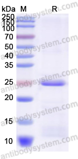 Recombinant Lassa virus/LASV GPC Protein, N-His