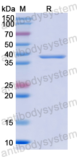 Recombinant PeVYV Putative read through protein P5 Protein, N-His-SUMO