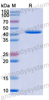 Recombinant SLEV NS1/Non-structural protein 1 Protein, N-His