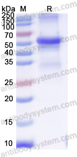 Recombinant Nipah virus/NiV G protein/Glycoprotein G Protein, N-His