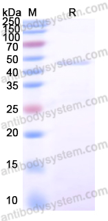 Recombinant Nipah virus/NiV F/Fusion glycoprotein F0 Protein, N-His