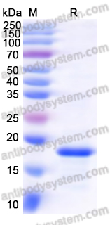 Recombinant HPV16 E6/Protein E6 Protein, N-His