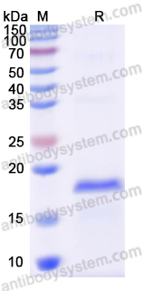 Recombinant HPV18 E6/Protein E6 Protein, N-His