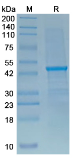 Recombinant CHIKV Spike glycoprotein E1 Protein, N-His