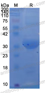 Recombinant CHIKV Spike glycoprotein E1 Protein, N-His