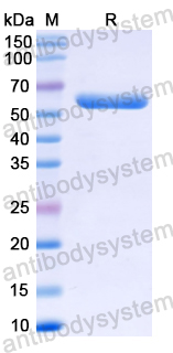 Recombinant Hepatitis E virus genotype 1/HEV-1 ORF2 Protein, N-His