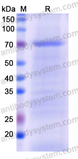 Recombinant Monkeypox virus/MPXV C18L Protein, N-His