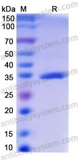 Recombinant Monkeypox virus/MPXV A27L Protein, N-His