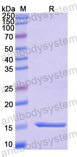 Recombinant Monkeypox virus/MPXV A29L Protein, N-His