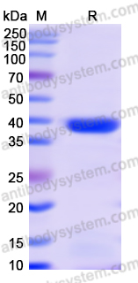 Recombinant Monkeypox virus/MPXV A29L Protein, N-GST & C-His