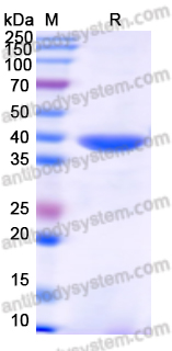 Recombinant Monkeypox virus/MPXV B16R Protein, N-His