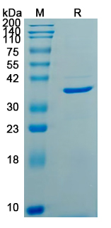 Recombinant HPV52 E7/Protein E7 Protein, N-GST & C-His