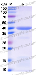 Recombinant Mojiang virus/MojV F/Fusion glycoprotein F0 Protein, N-His