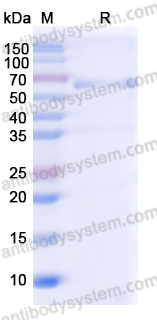 Recombinant Langya virus/LayV N/Nucleocapsid protein Protein, N-His