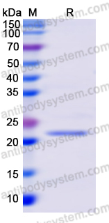 Recombinant Langya virus/LayV F/Fusion Protein, N-His-SUMO