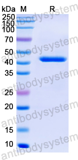 Recombinant Nipah henipavirus M/Matrix Protein, N-His