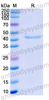 Recombinant Nipah virus/NiV M/Matrix Protein, N-His