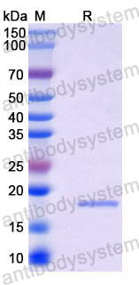 Recombinant Langya virus/LayV Phosphoprotein Protein, N-His