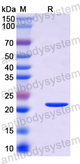 Recombinant Langya virus/LayV V Protein, N-His