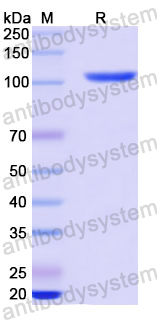 Recombinant Langya virus/LayV Polymerase Protein, N-His