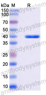 Recombinant Langya virus/LayV Polymerase Protein, N-His