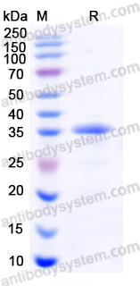 Recombinant Coxsackievirus A16 VP1 Protein, N-His