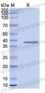 Recombinant HIV-1 p24/Capsid protein p24 Protein, N-His-SUMO