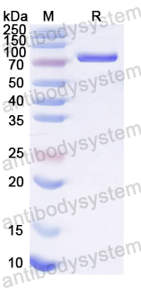 Recombinant HPV B19 NS1/Non-structural protein 1 Protein, N-His