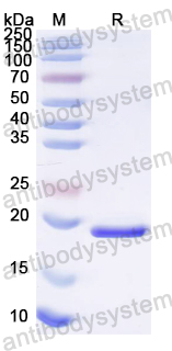 Recombinant HPV B19 VP1/Coat protein VP1 Protein, N-His