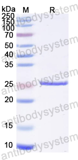 Recombinant EBV/HHV-4 gB/BALF4 Protein, N-His