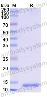 Recombinant SARS-CoV-2 ORF9b Protein, N-His