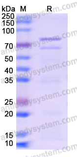 Recombinant Bacteriophage T4 DNA ligase/30 Protein, N-His-SUMO & C-Strep