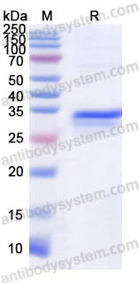 Recombinant Influenza A virus (H1N1) M2e Protein, N-GST & C-His