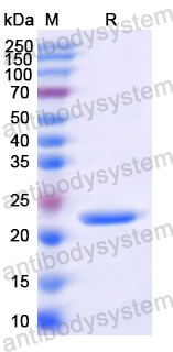 Recombinant MARV GP1/Envelope glycoprotein 1 Protein, N-His