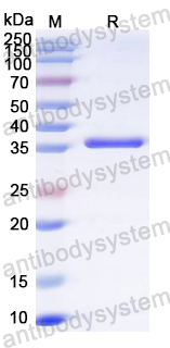 Recombinant Norwalk virus Capsid Protein, N-His