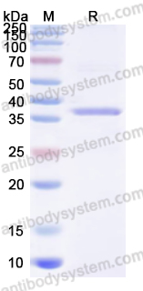 Recombinant Poliovirus type 1 VP1/Capsid protein VP1 Protein, N-His