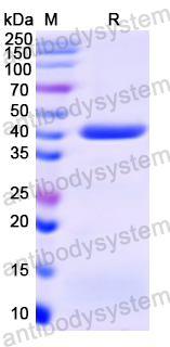 Recombinant HMPV Matrix protein/M Protein, N-His-SUMO